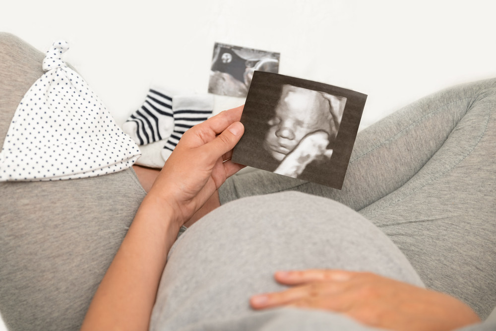 Pregnant,Woman,Holding,4d,Ultrasound,Image.,Expectation,Of,A,Child