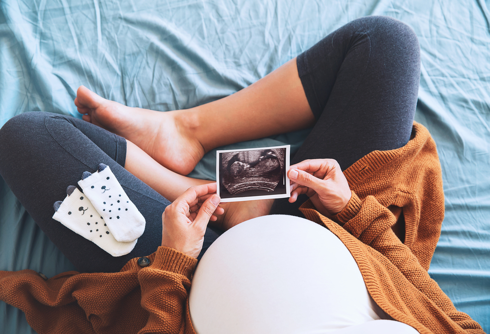 Pregnant,Woman,Holding,Ultrasound,Image.,Concept,Of,Pregnancy,,Health,Care,