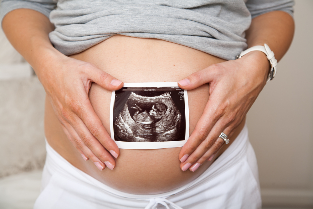 Close,Up,Of,Pregnant,Woman,Holding,Ultrasound,Scan,On,Her